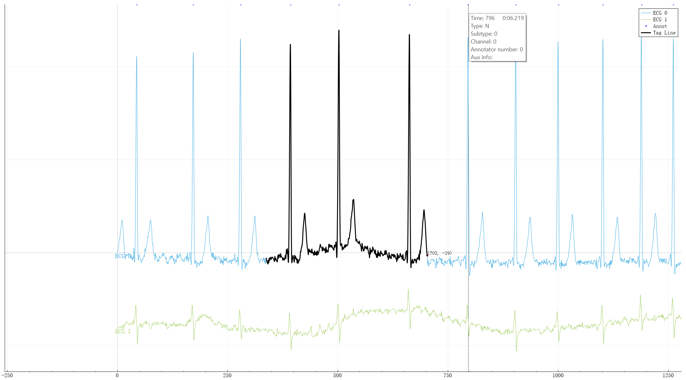 EcgViewer